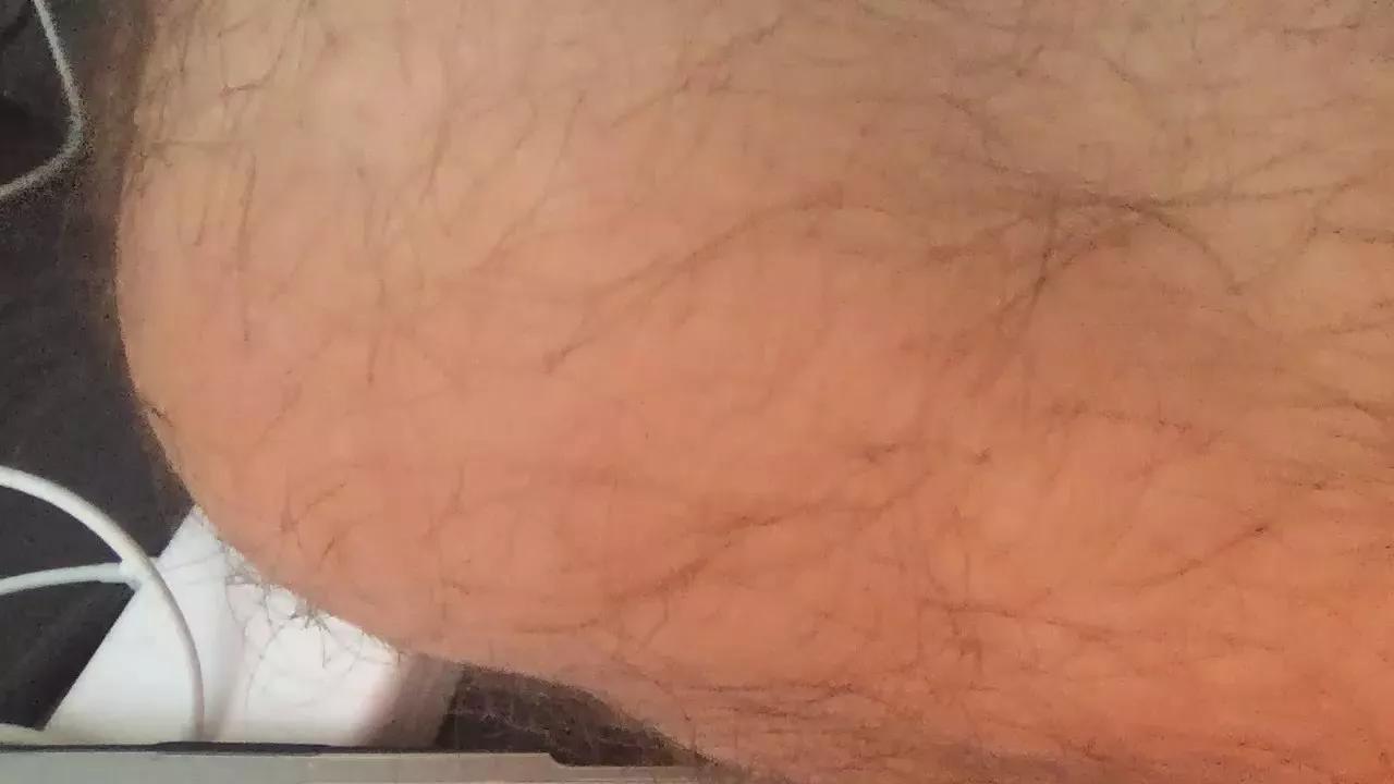 rhotfun